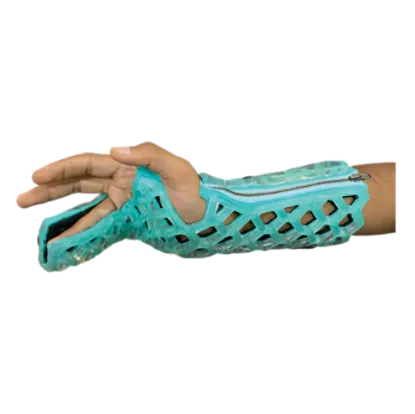 Picture of FlexiCast Ulnar Gutter Immobilizer